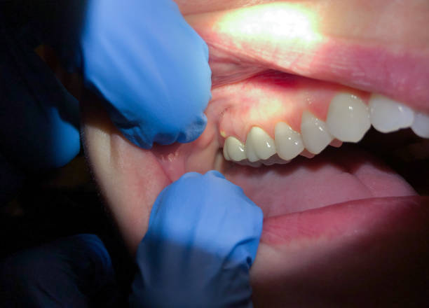 Best Pediatric Emergency Dentist in Hollymead, VA