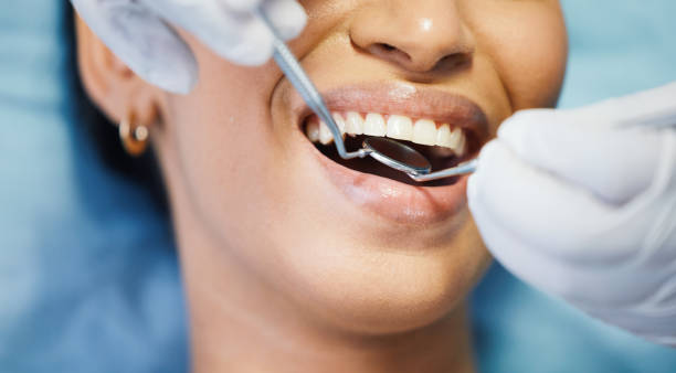 Best Emergency Tooth Extraction in Hollymead, VA