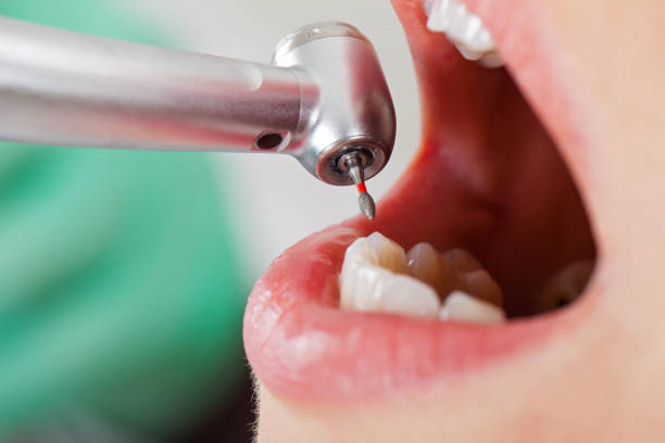 Best Weekend Emergency Dentist in Hollymead, VA